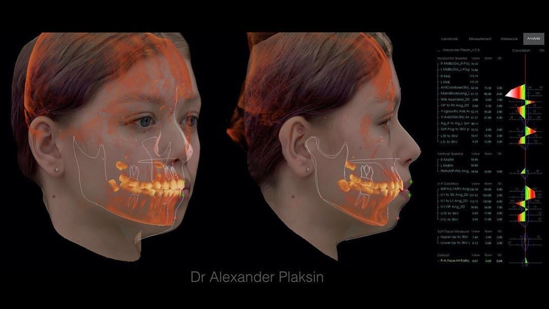 Диагностика зубов с помощью искусственного интеллекта!