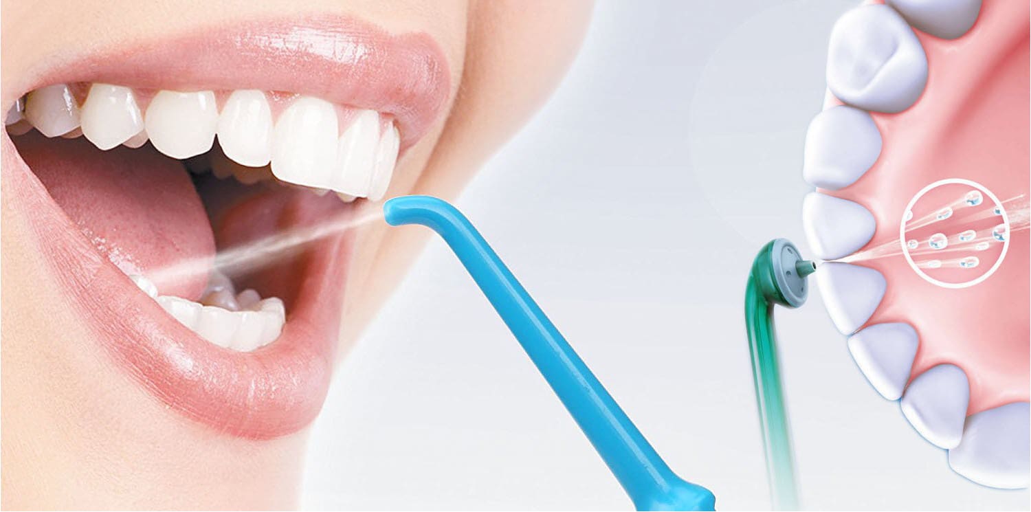 Чистка зубов после лечения. Профгигиена (ультразвук + Air-Flow). Профгигиена полости рта Air Flow.